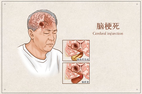 zDW(wng)_401789965_Xt(y)宋(hu)I(y)ã.jpg