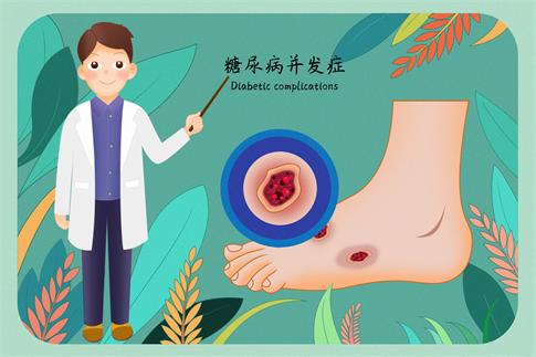 1688437667471521.jpg 攝圖網_401865897_banner_糖尿病并發癥糖尿病足醫療插畫(企業商用).jpg