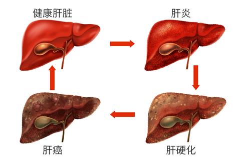1718236176135802.jpg 攝圖網_401806707_banner_乙肝肝臟病變癥狀醫療插畫(企業商用).jpg