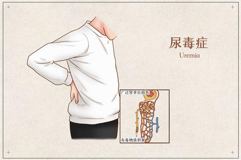 1735344624431938.jpg 攝圖網_401794004_尿毒癥醫療插畫(企業商用).jpg
