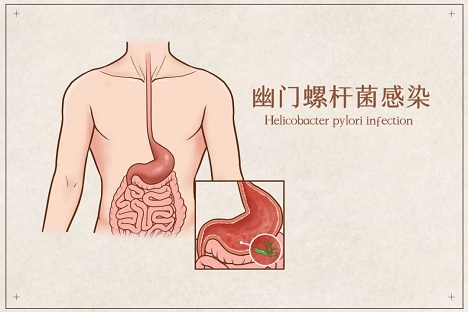 1756339184254685.jpg 微信圖片_20250828074434.jpg